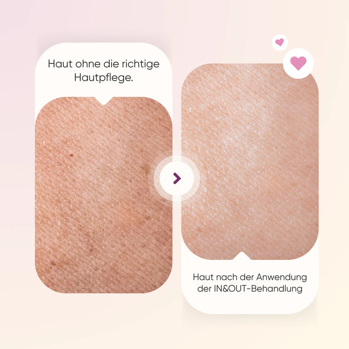 Kit Été In & Out | Démaquillant + Sérum Anti-Rides + Crème Visage Moringa + Complément Collagène