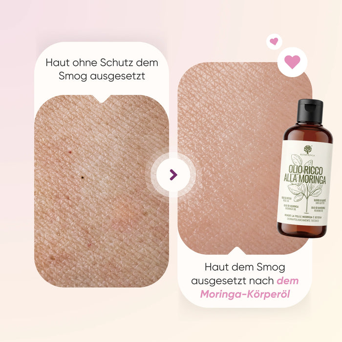 Kit Anti-Cellulite Ete | Complement + Microcirculation + Huile Corps + Moringlow + Sac